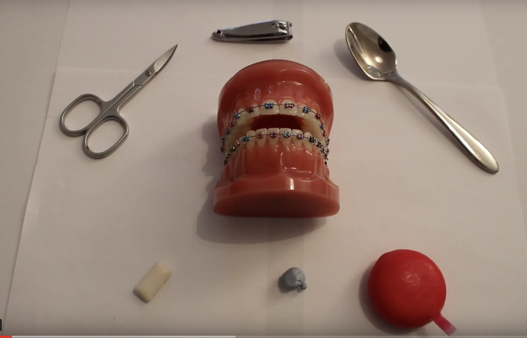 Home Advice - do you have issues with the wires on your orthodontic braces?