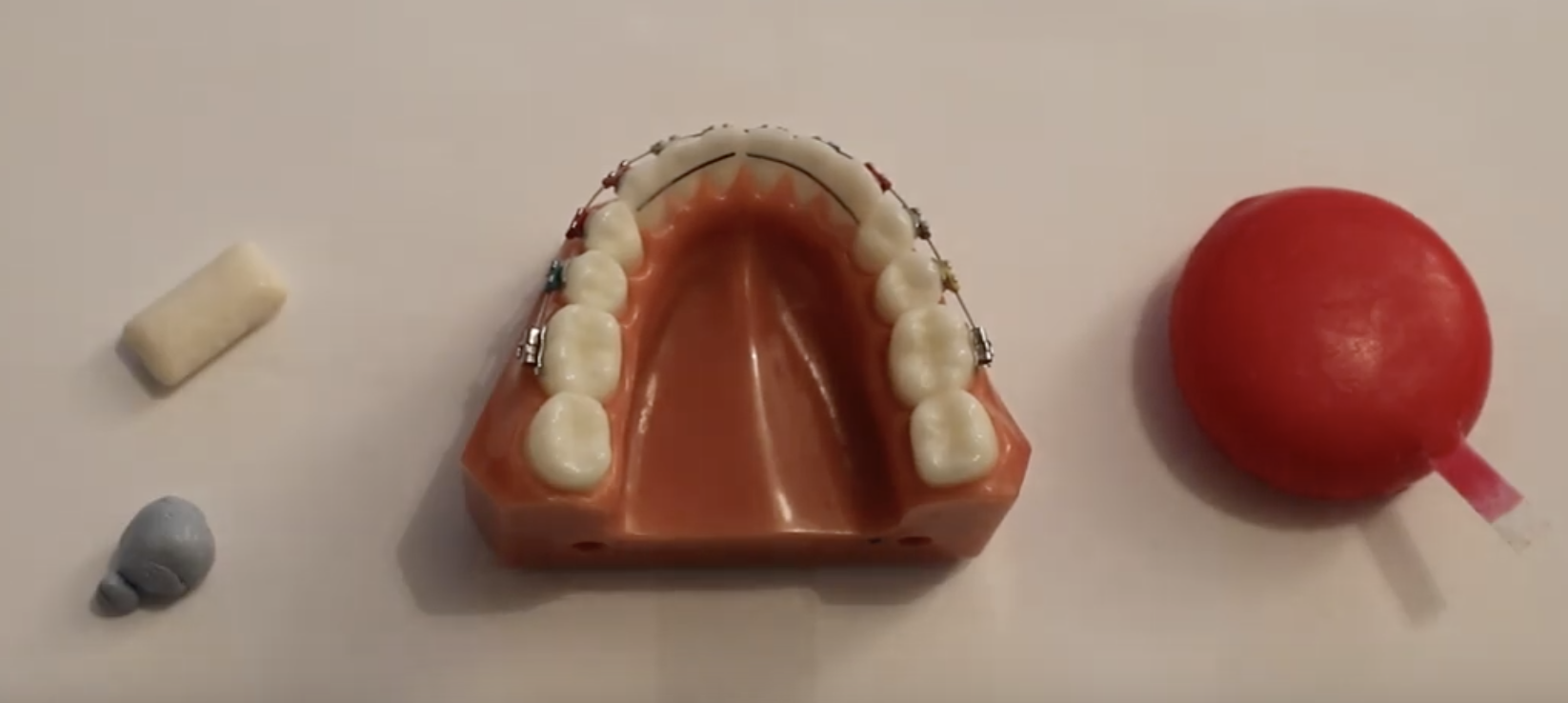 Broken bonded retainer advice