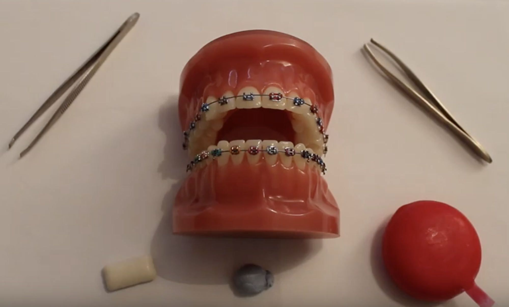 Loose module or loose wire on your braces