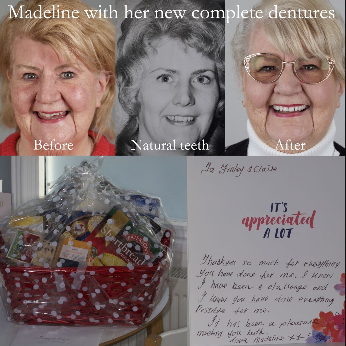 Madeline loves her new lifelike complete dentures