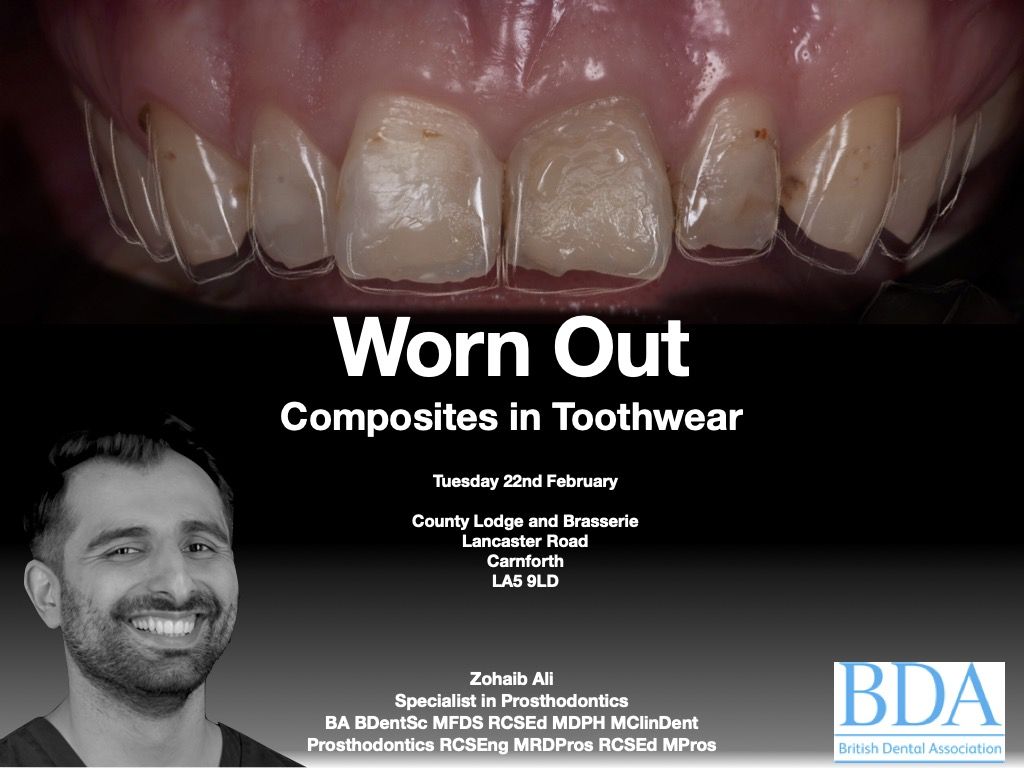 Worn out - Composites in toothwear - Face-to-Face lecture by Dr Zo Ali, Specialist in Prosthodontics