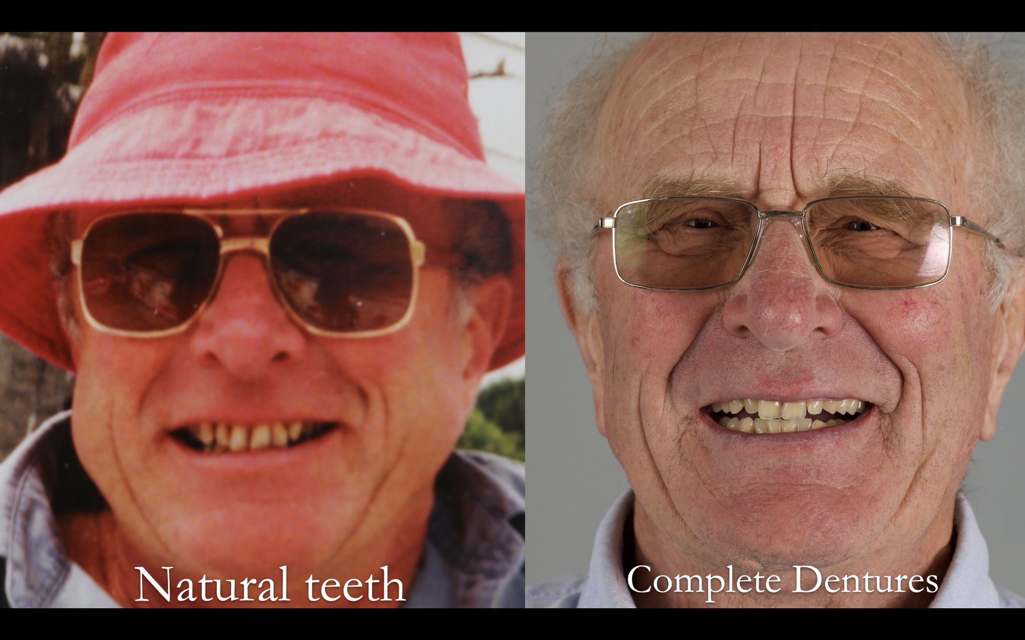 No one knows they are dentures....