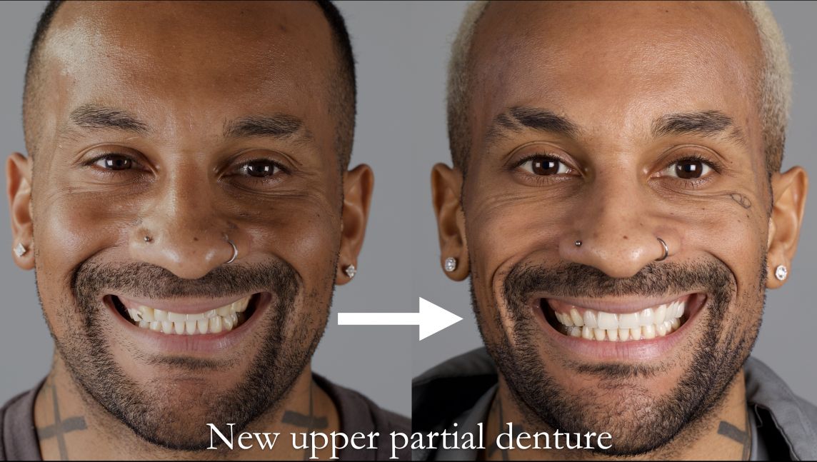 James loves his new smile