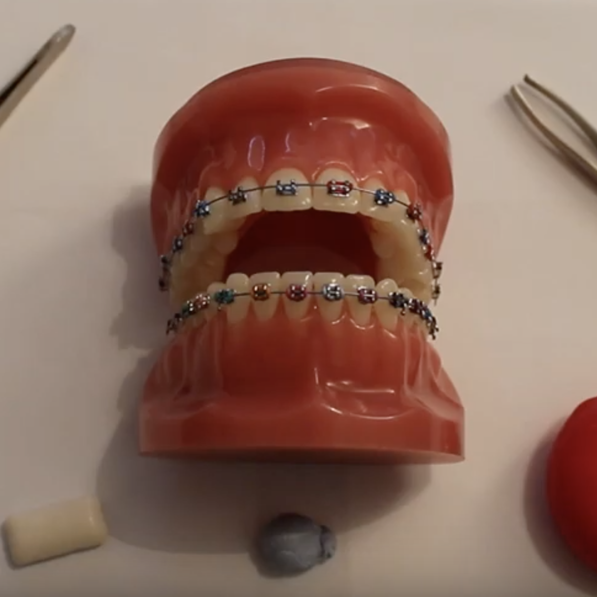 Loose module or loose wire on your braces | Garstang Dental